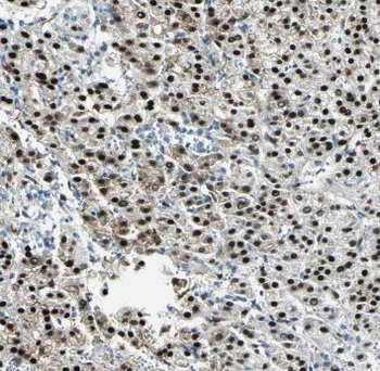 PSMA7 Antibody