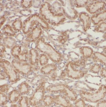PSMA8 Antibody