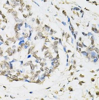 PSMB1 Antibody