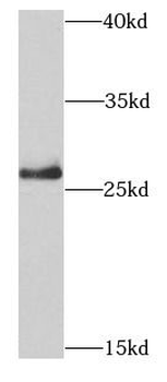 PSMB10 Antibody