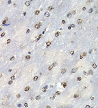 PSMB10 Antibody
