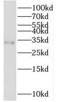 PSMB11 Antibody
