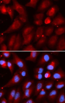 PSMB2 Antibody