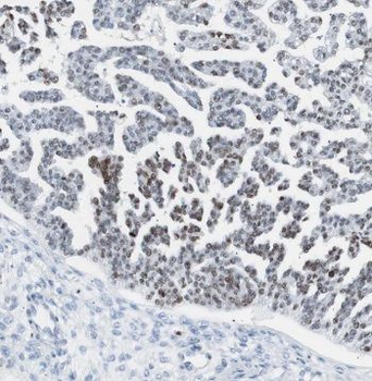 PSMB2 Antibody