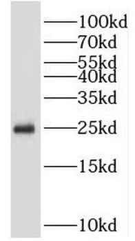 PSMB4 Antibody