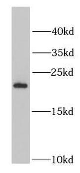 PSMB5 Rabbit Polyclonal Antibody