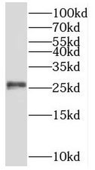 PSMB6 Antibody