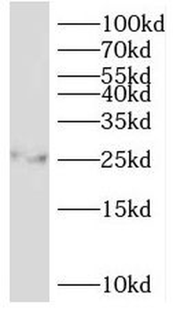 PSMB7 Antibody