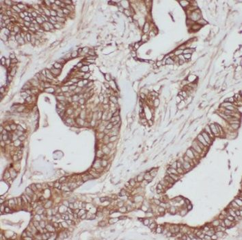 PSMB7 Antibody