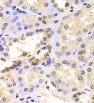 PSMC6 Antibody