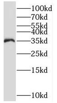 PSMD14 Antibody