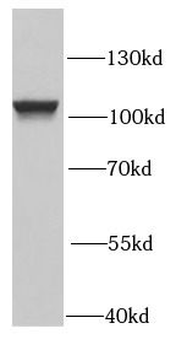 PSMD2 Antibody