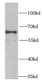 PSMD3 Antibody
