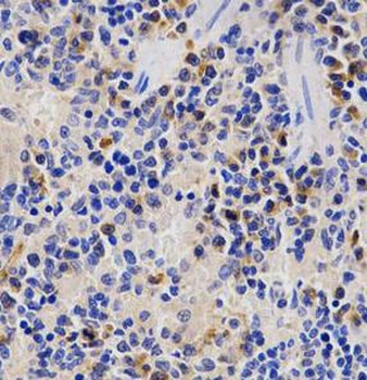 PSMD3 Antibody