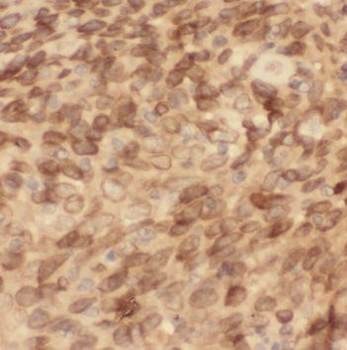 PSMD4 Antibody