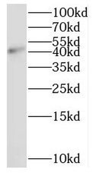 PSMD6 Antibody