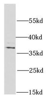 PSMD7 Antibody
