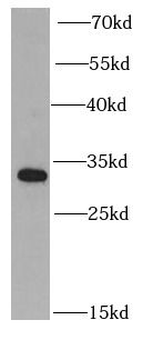 PSME2 Antibody