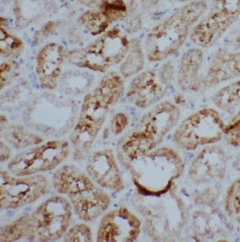 PSME2 Antibody