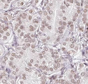PSMG2 Antibody