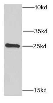 PSPH Antibody