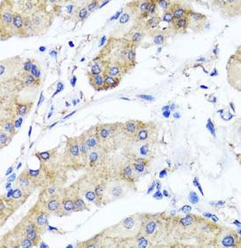 PSTPIP1 Antibody