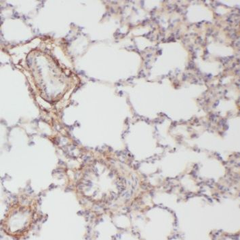 PTAFR Rabbit Polyclonal Antibody
