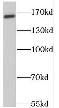 PTCH1 Antibody