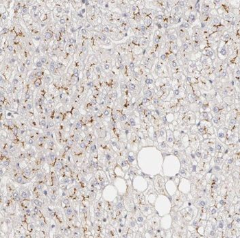 PTCH1 Antibody