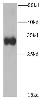 PTGDS Antibody