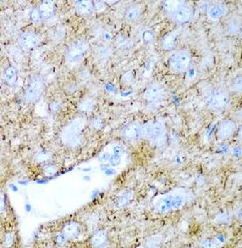PTGDS Antibody