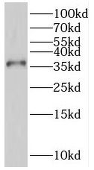 PTGR1 Antibody