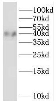 PTGR2 Antibody