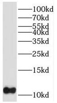 PTMS Rabbit Polyclonal Antibody