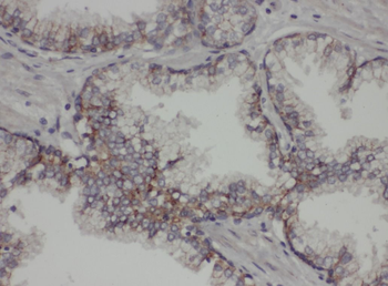 PTPN1 Antibody