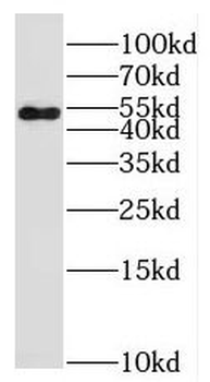 PTP4A1 Antibody