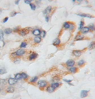 PTP4A1 Antibody