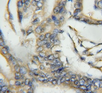PTPMT1 Antibody
