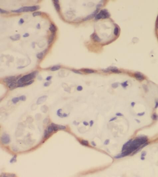 PTPN14 Antibody