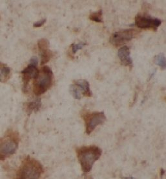 PTPN18 Antibody