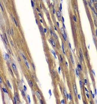 PTPN2 Antibody