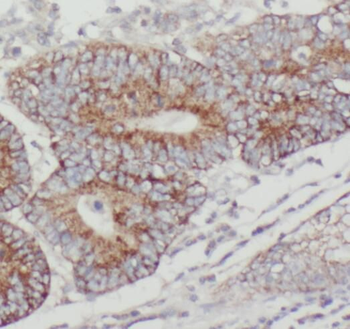PTPN23 Antibody