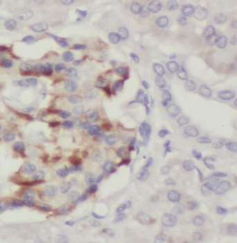 PTPN4 Antibody