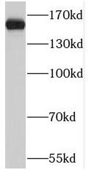 PTPRJ Rabbit Polyclonal Antibody