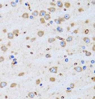 PTRH2 Antibody