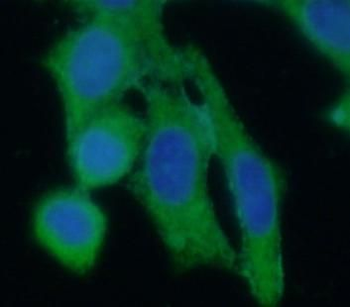 PTS Antibody