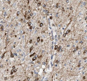 PTS Antibody