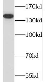PUM2 Rabbit Polyclonal Antibody
