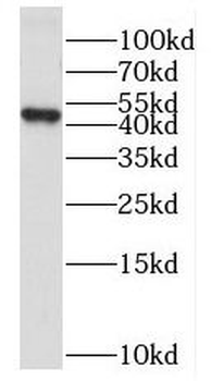 PUS1 Rabbit Polyclonal Antibody