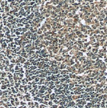 PVRIG Antibody